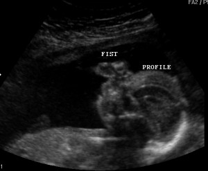... baby ultrasound 33 weeks pregnant ultrasound funny baby ultrasound