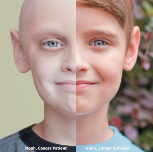 ... and After Photos of Children Cancer Survivors Will Melt Your Heart