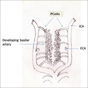 Interne arteries internal carotid artery internal carotid carotid