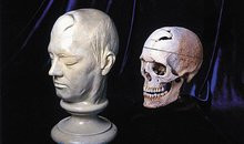 Phineas Gage: Neuroscience's Most Famous Patient