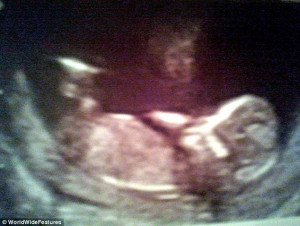 ... face of an angel in pregnancy scan watching over her baby in the womb