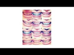 How to choose braces colors More