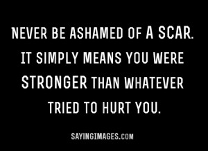 Scar Simply Means You’re Stronger Than Whatever Tried O Hurt You ...