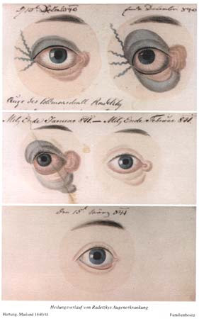 will next quote from Tract 5 of the Homœopathic League Series the ...