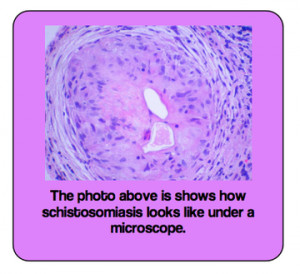 Chicken Pox Under Microscope