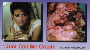 Drunk Driving Victims Before and After