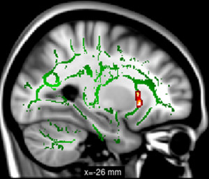 Motivational Quotes Outsourced Call Center Tacamor