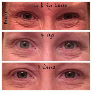 ! Reduce those lines and wrinkles with Lip & Eye Cream! Look at those ...