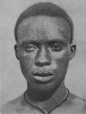An Igbo man with Ichi marks, a sign of rank as an Ozo [ 10 ]