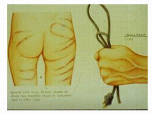 File Name : Child_%20Physical_Abuse.png Resolution : 640 x 480 pixel ...