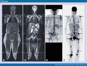Female Full Body MRI Scan