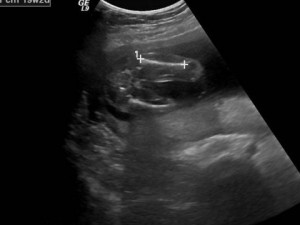 Update Help Decipher Please