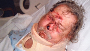 Veteran who was brutally beaten by black thugs in an unprovoked ...