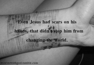 Even Jesus had scars on his hands, that didn’t stop him from ...