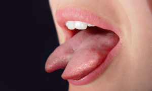 More Tongue Splitting Split