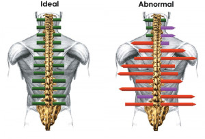 Go Back > Gallery For > Chiropractic Spine Alignment