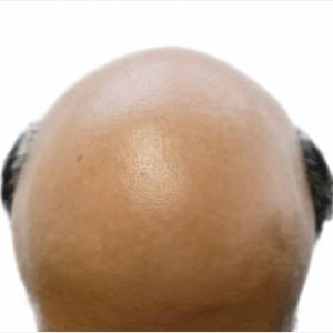 Top Quotes, Words of Wisdom and Witticisms on Baldness Anything