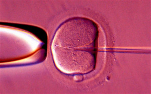 Seeds of doubt: a human egg is fertilised in vitro - The chance to ...