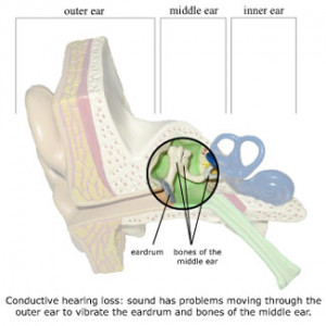 How Improve Hearing Loss