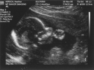 baby ultrasound quotes