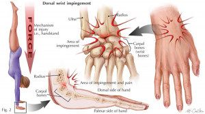 To keep from making injuries worse you need to recognize an acute or ...