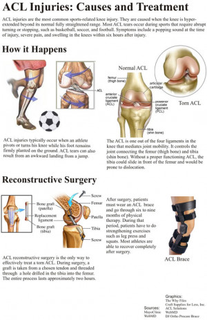 figure 9 acl causes and treatment
