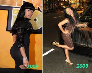 Nicki Minaj: Plastic Surgeries, Before and Afters