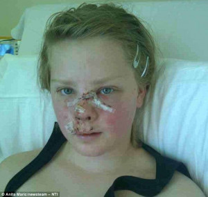 Girl, 13, savaged by German shepherd puppy which left her needing 50 ...