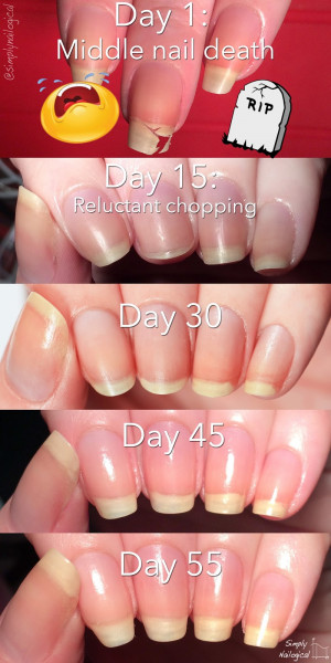 Leaving the nub club: How to grow your nails