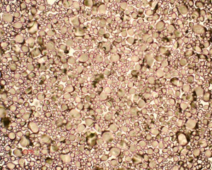 Potato Cells Under Microscope