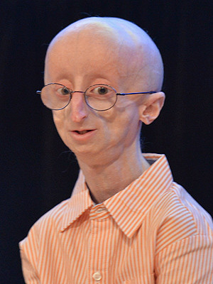 Sam Berns, Remarkable 17-Year-Old with Rare Aging Disease, Dies