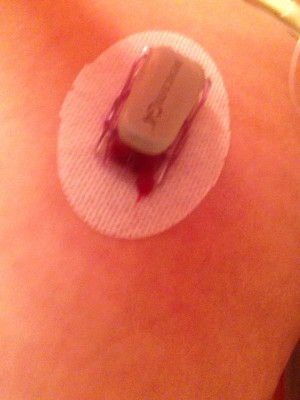 Let me repeat that. My doctor is 50+ year T1D .