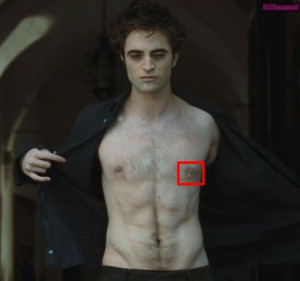 perhaps a vampire bite which does leave a scar robsessed