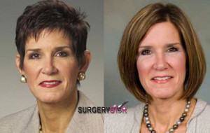 Previous Post Politician Mary Matalin Rumored Had Plastic Surgery