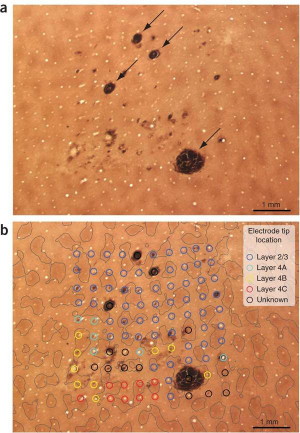 Go Back > Gallery For > Implantation Bleeding Color And Consistency ...
