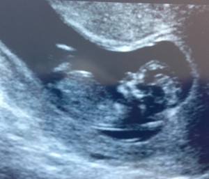 Funny Quotes Contact Us DMCA Notice