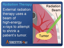 radiotherapy also known as radiation therapy