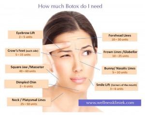 Botox Preise Behandlung And
