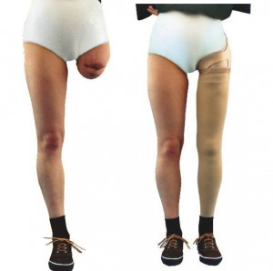 ... her artificial prosthetic leg at security check in the Mumbai airport