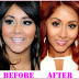 Snooki Plastic Surgery Before and After
