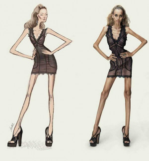 Kate Moss Anorexia Quote Say no to anorexia!