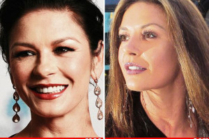 and plastic surgery famous people and plastic surgery famous people ...