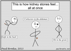 kidney stones