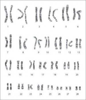 Karyogram Chromosomes
