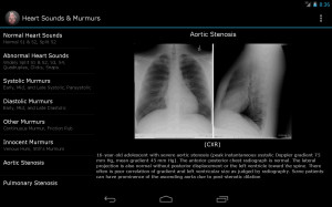 Heart Sounds & Murmurs - screenshot