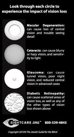 eye diseases: cataract, glaucoma, macular degeneration and diabetic ...