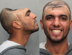 man with half of head bad mug shots, funny mug shots, crazy, wtf, fail ...