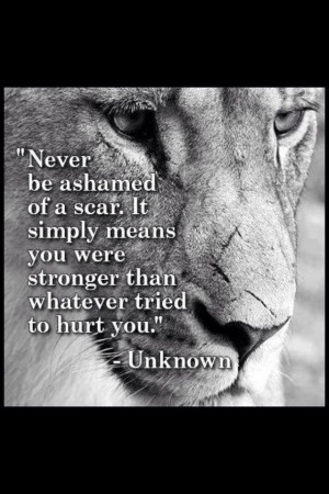 Never be ashamed of a scar! It simply means you were stronger than ...