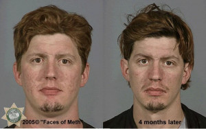 Faces of Meth ¬ 2005 James
