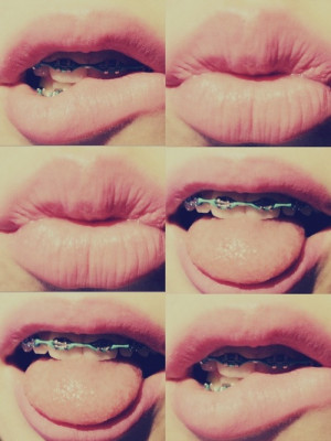 Tumblr Braces Lips